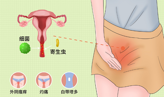 全自动阴道分泌物检测仪 女性全自动阴道分泌物检测仪查什么?怎么查?这些细节你了解吗?